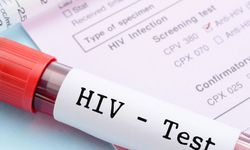 Bakanlık açıkladı... HIV virüsü taşıyan kişiye çalışma izni verildi mi?