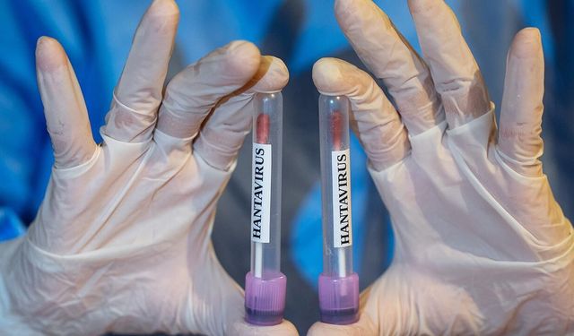 Güney Kıbrıs’ta Hantavirüsüyle ilgili hazırlık planı